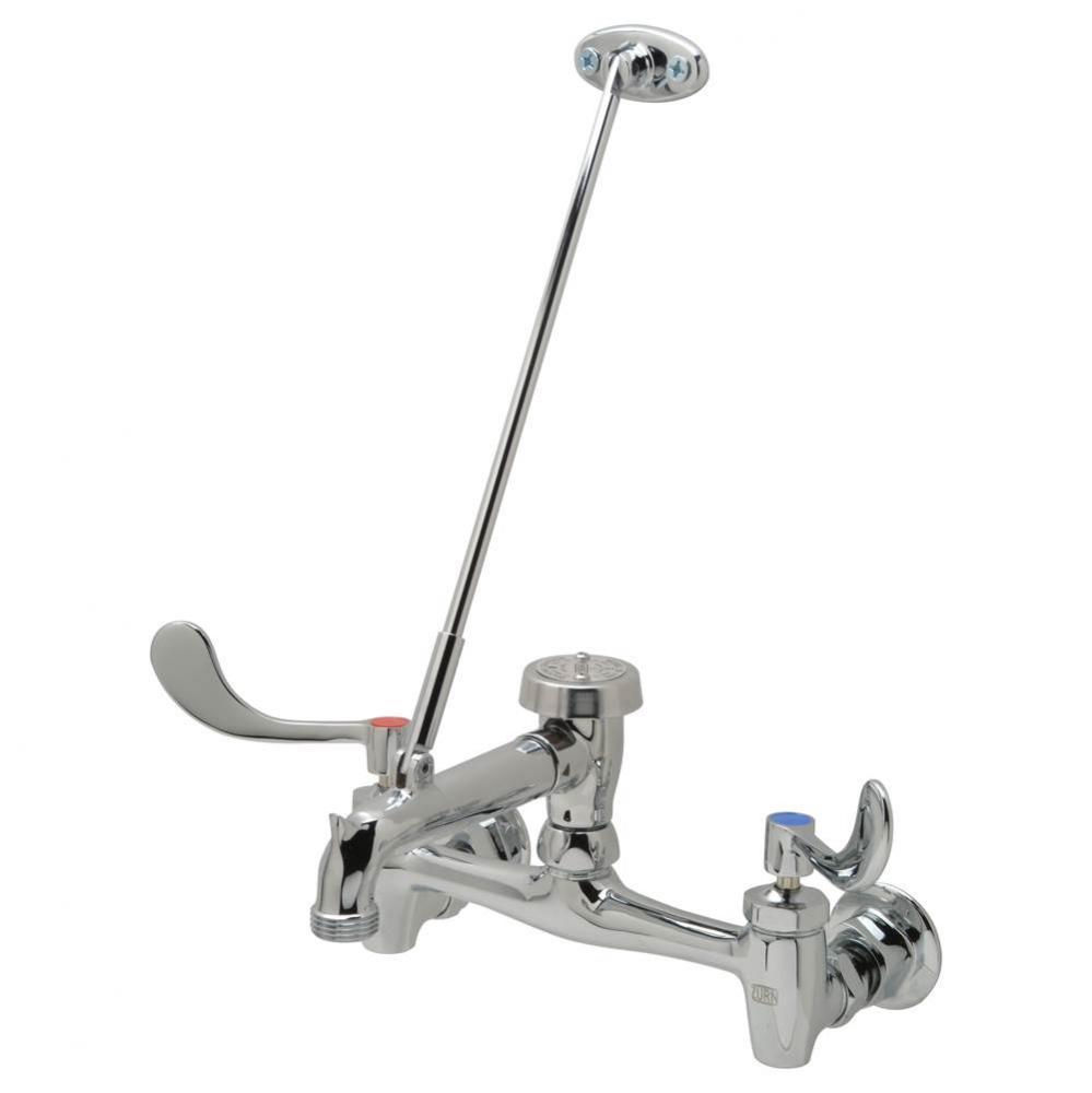 SERV SINK FCT (XL), 6'' VB SPT, PAIL HK, 3/4'' HOSE OUTLET